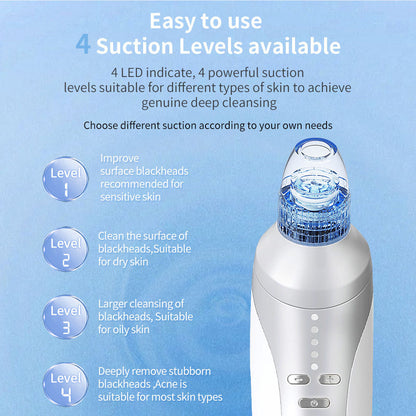 Blackhead Suction Instrument, Electric Blackhead Suction Artifact, Blackhead Removal Instrument, Home Use Beauty Instrument For Sucking Blackheads And Acne